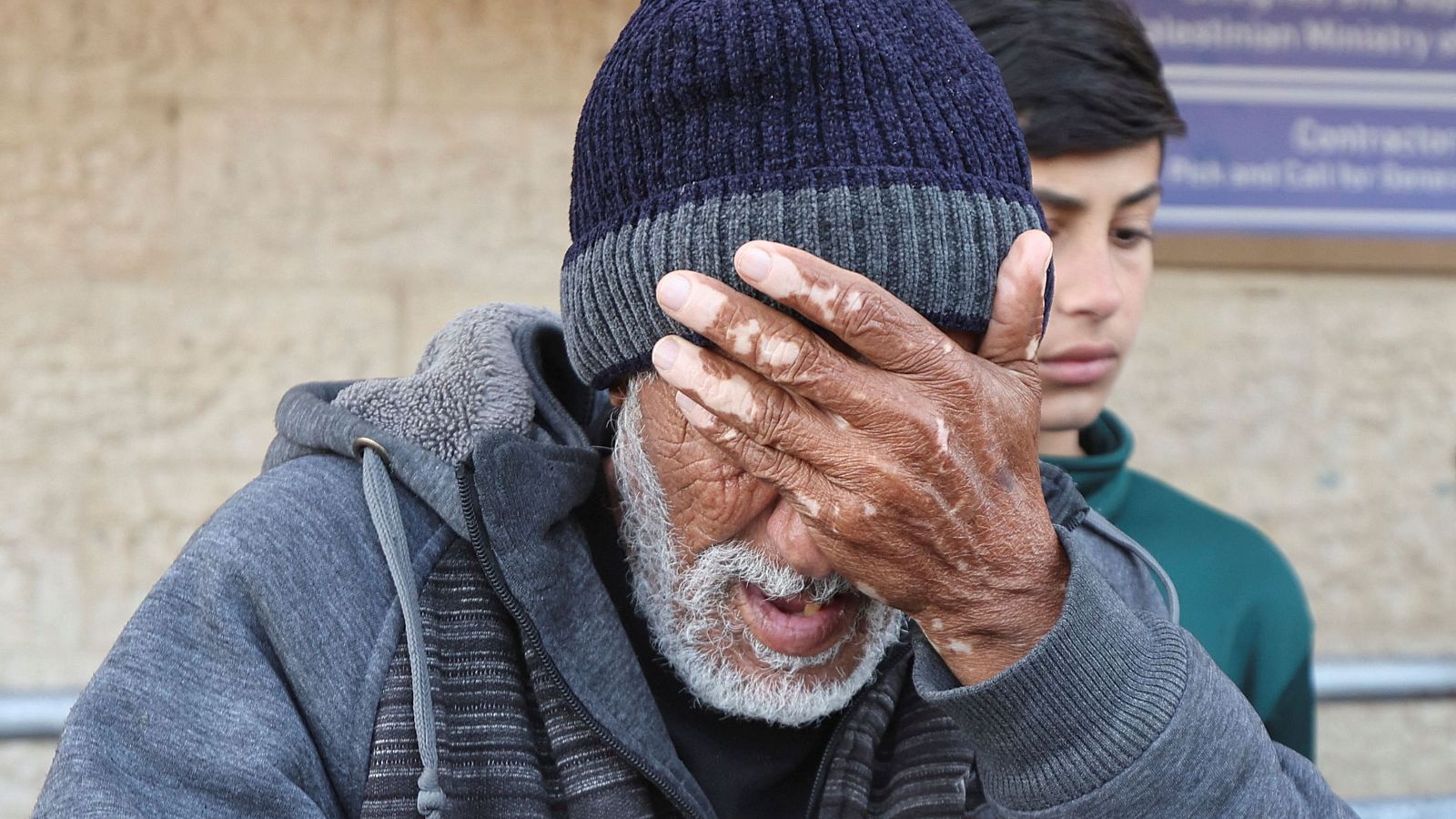 Hombre mayor con vitíligo, gorro y sudadera gris, se cubre la cara con la mano mostrando dolor. Fondo de pared de piedra; detrás, un joven con ropa verde.