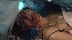 Aquest és el benefici de mantenir el pacient despert durant una operació de tumor cerebral