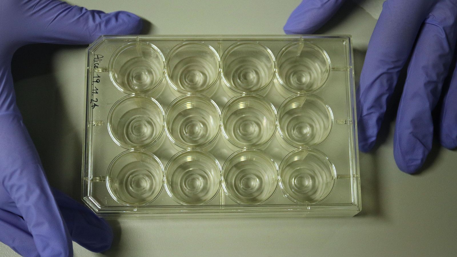 Placa de cultiu, cadascun dels pous conté un dispositiu MIRO. | Hospital del Mar