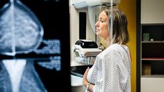 Los oncólogos denuncian presiones de la sanidad privada para reducir los costes de algunas terapias contra el cáncer
