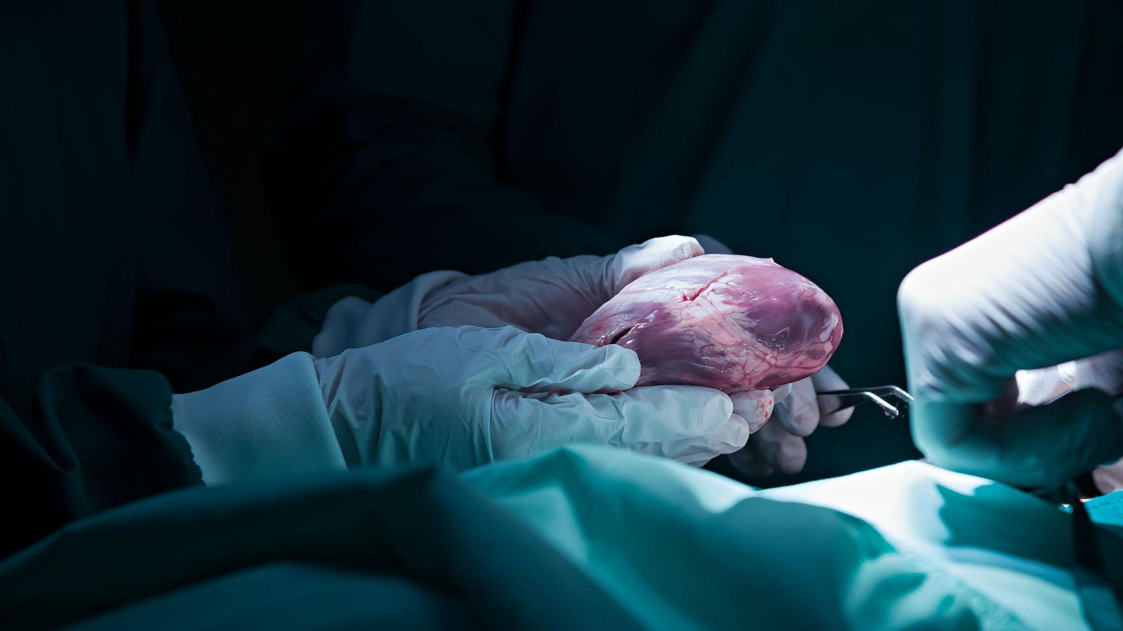 España récord de trasplantes en 2024