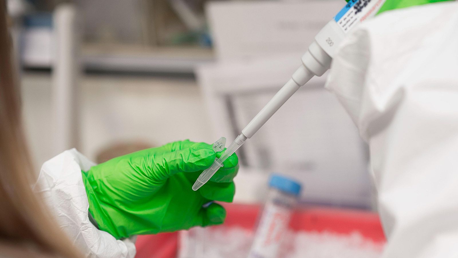 Un análisis de bilis podría identificar pacientes con riesgo de desarrollar colangiocarcinoma