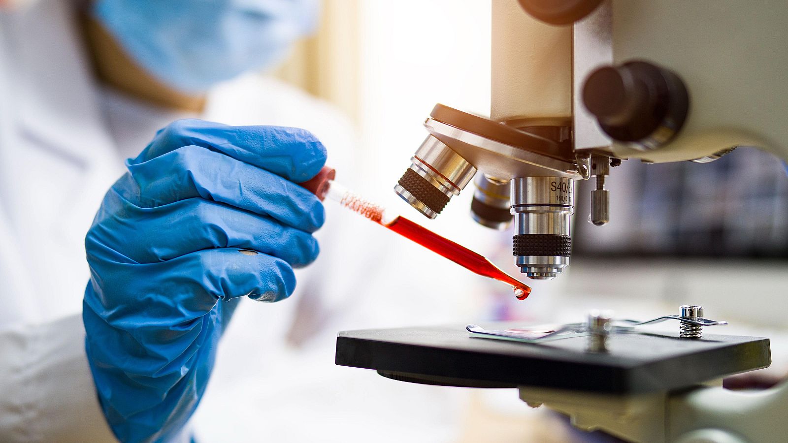 Sanidad elimina la exclusión de las personas con VIH de las terapias CAR-T para pacientes oncológicos