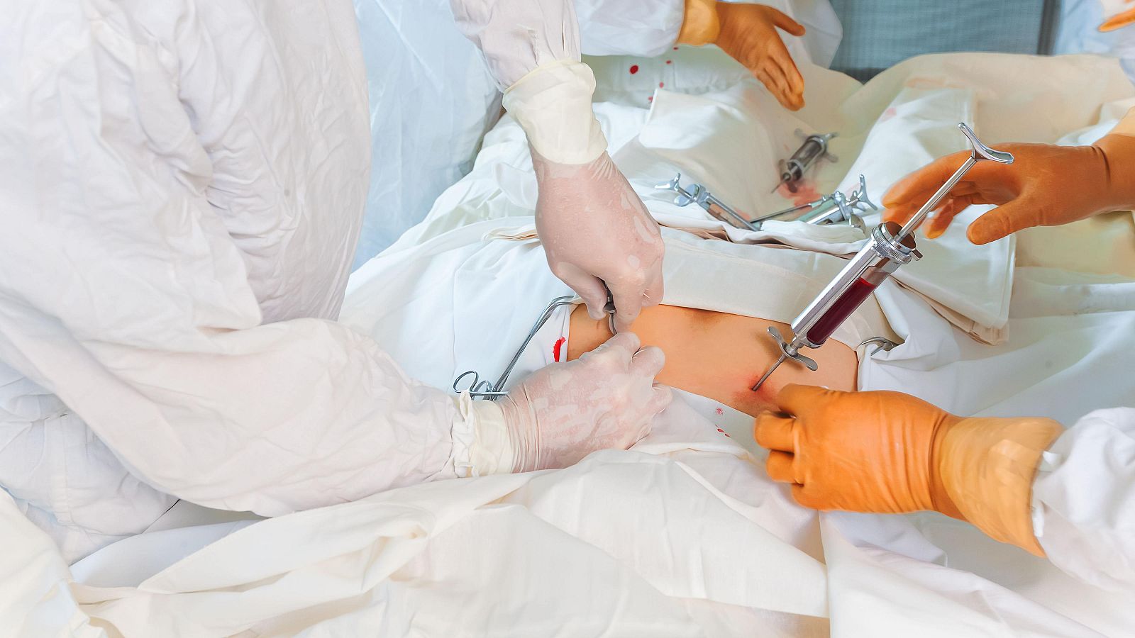 Trasplante de médula ósea