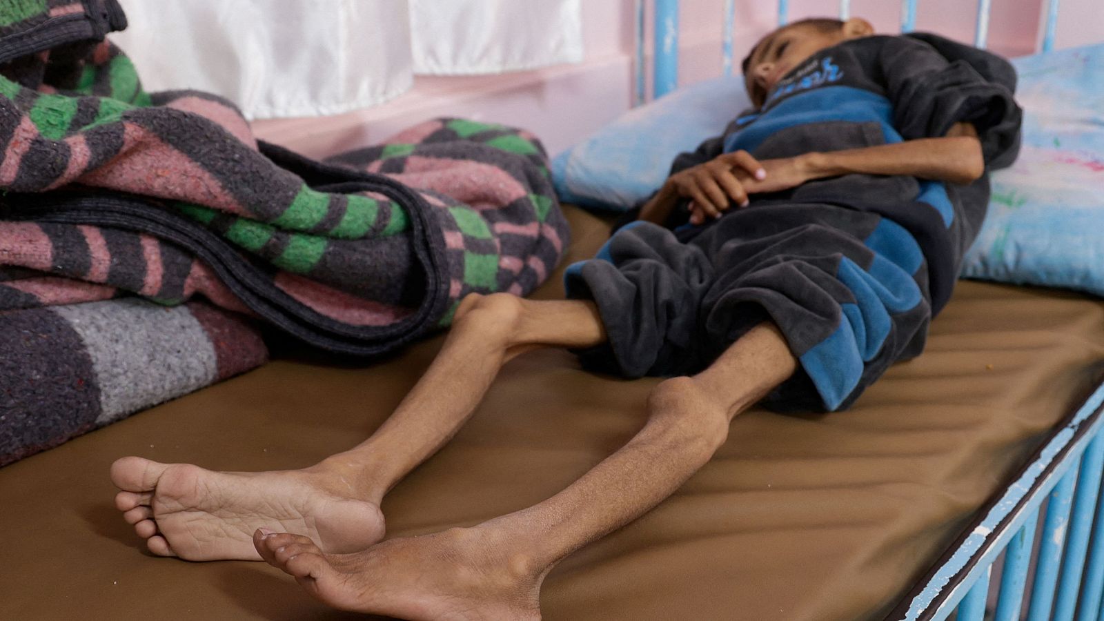 Osama Al-Reqep, de 5 años, yace en una cama en el Hospital Nasser donde recibe tratamiento, en Jan Younis