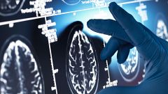 Investigadores de la Universidad de Castilla-La Mancha consiguen revertir déficits de memoria al principio del Alzheimer