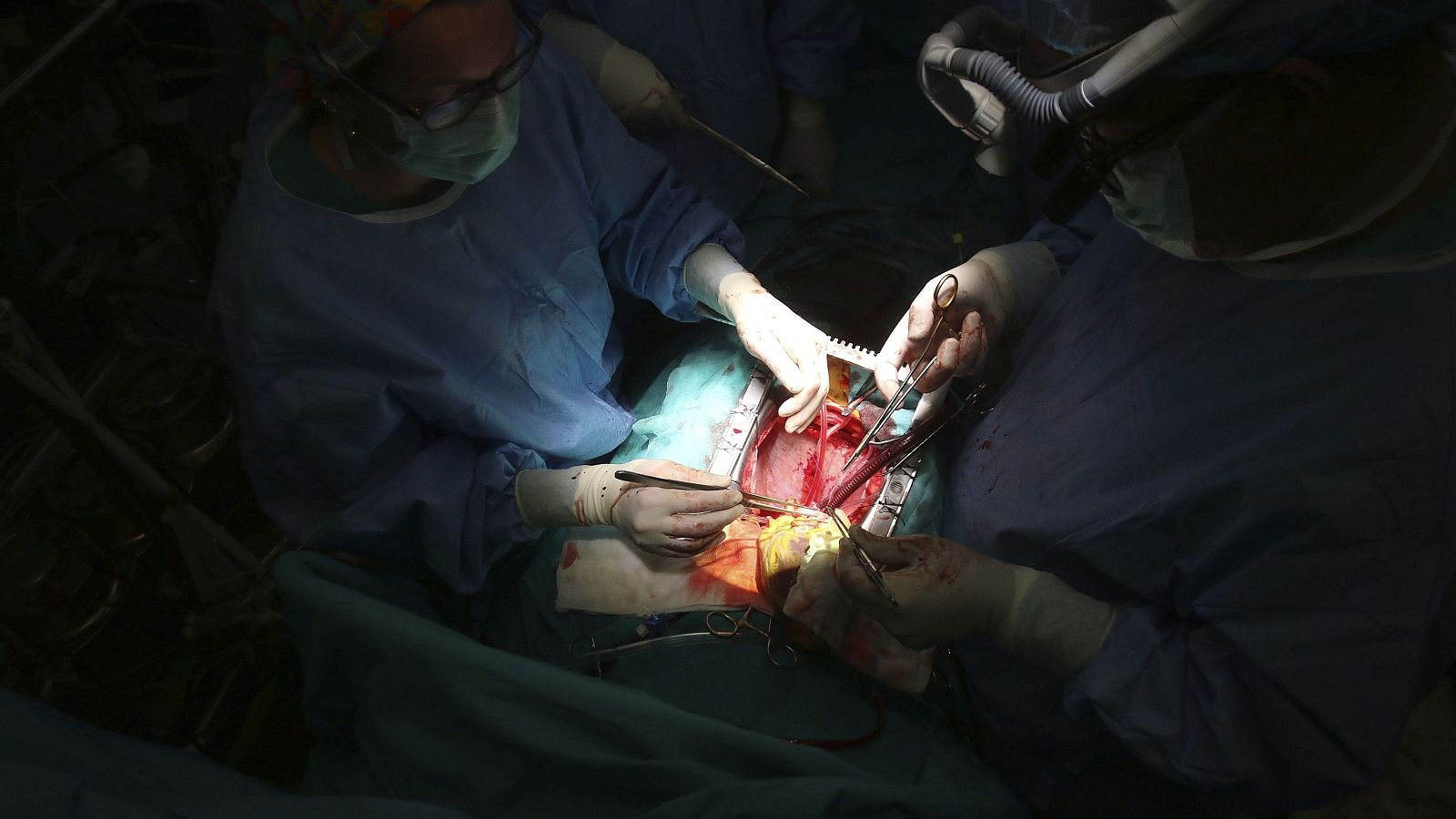 Este miércoles 4 de junio se conmemora el Día Nacional del Donante de Órganos y Tejidos