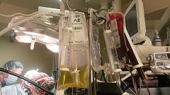 Carla, primer bebé español en recibir un trasplante cardíaco incompatible con su sangre