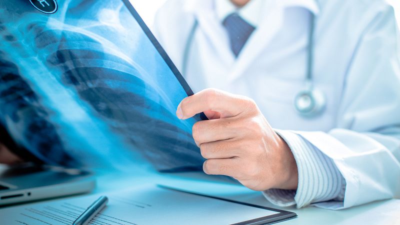 Investigadores españoles consiguen revertir tumores de pulmón avanzados en ratones