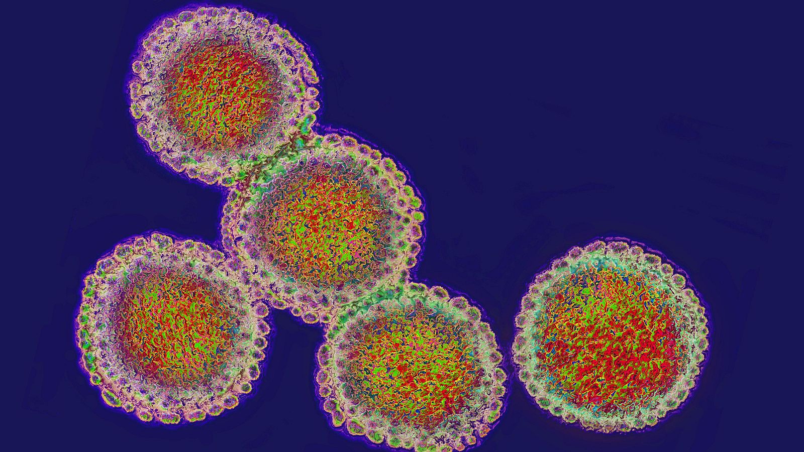 Imagen del virus de la gripe aviar