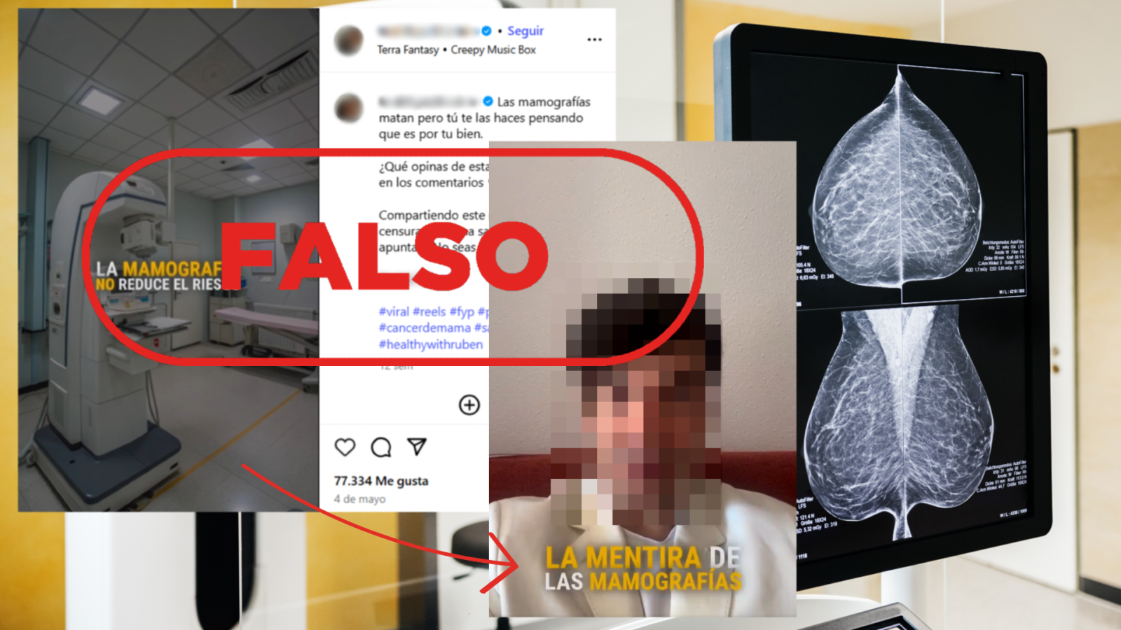 Este vídeo contiene información falsa sobre las mamografías