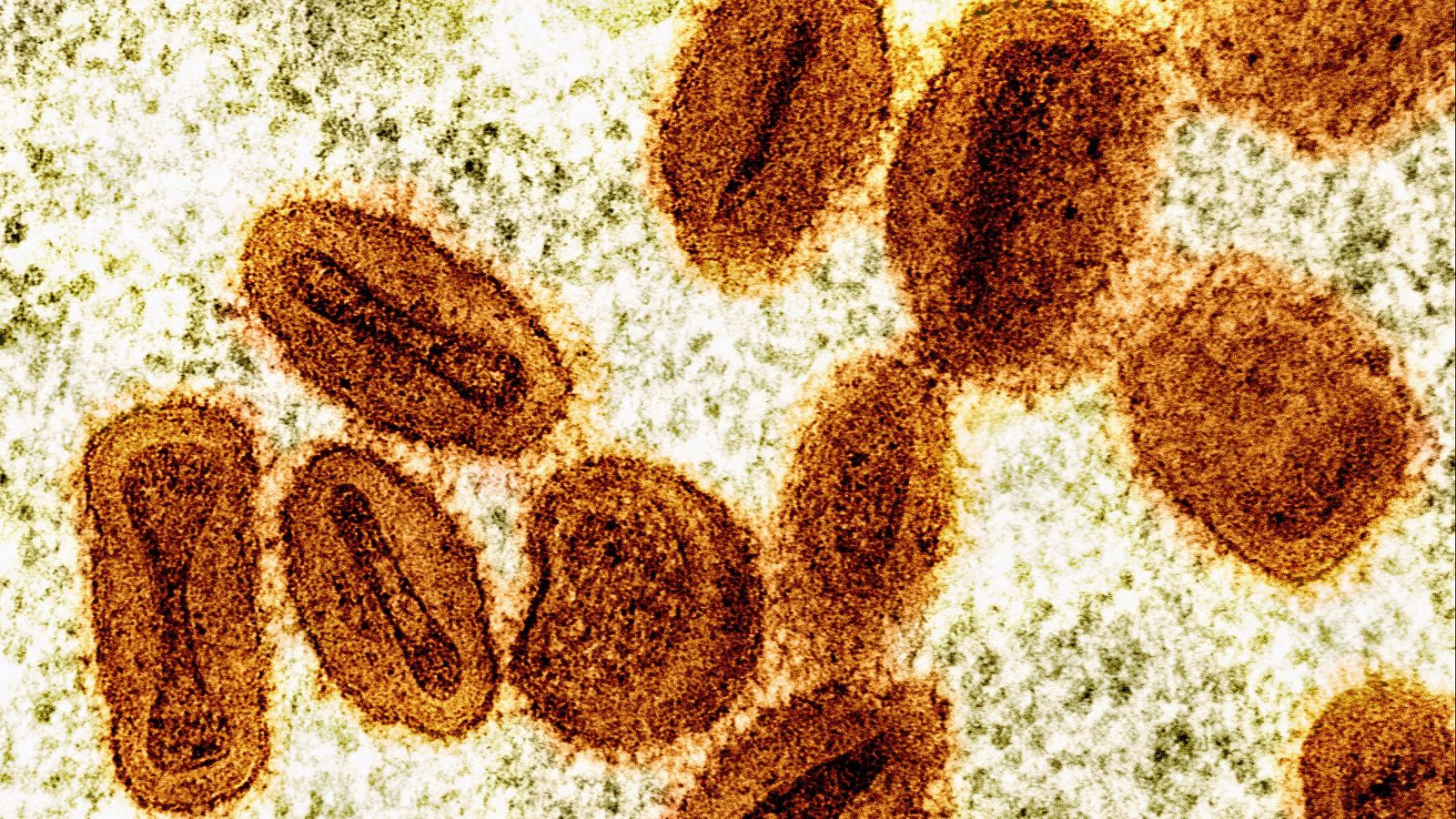 La OMS levanta la emergencia sanitaria internacional por la mpox