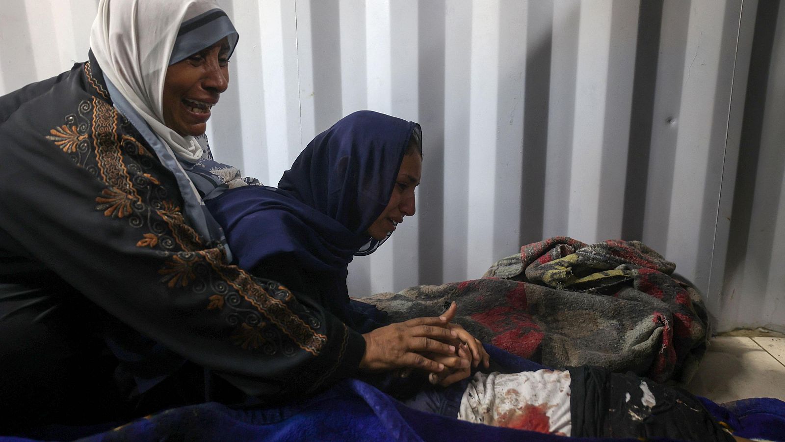 Sanitarios en Gaza relatan lesiones "inusualmente graves"