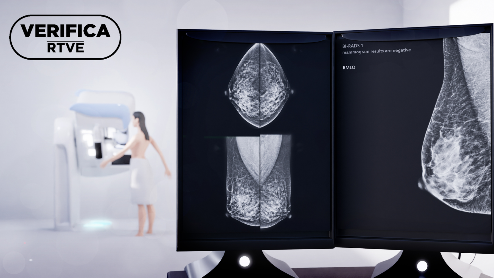 ¿Qué es y cómo funciona el cribado de cáncer de mama en España?