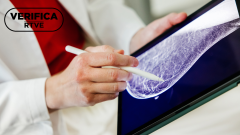 Cáncer de mama: así puede la inteligencia artificial mejorar su detección