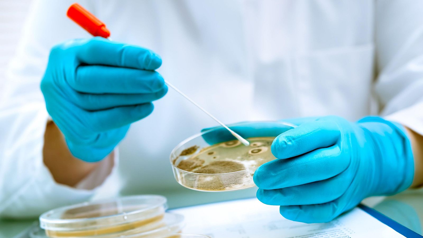 Alerta por un lote de queso de cabra con listeria y E.coli.