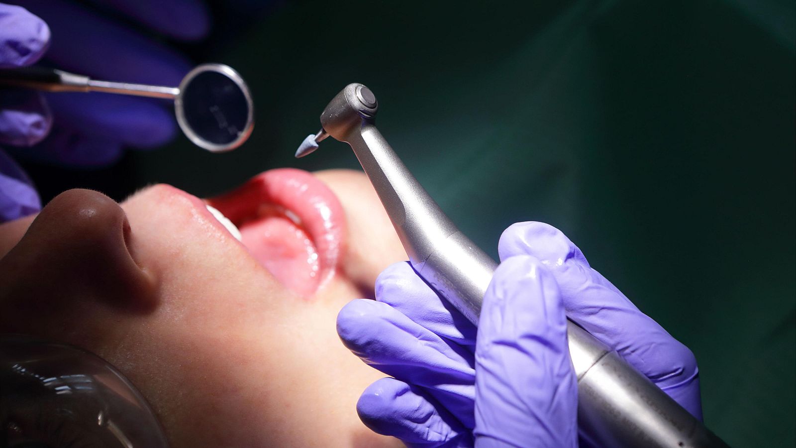 En primer plano, se observa una boca abierta durante una reparación dental, con un odontólogo utilizando un torno y un espejo dental. La imagen destaca la zona de trabajo con una iluminación intensa.