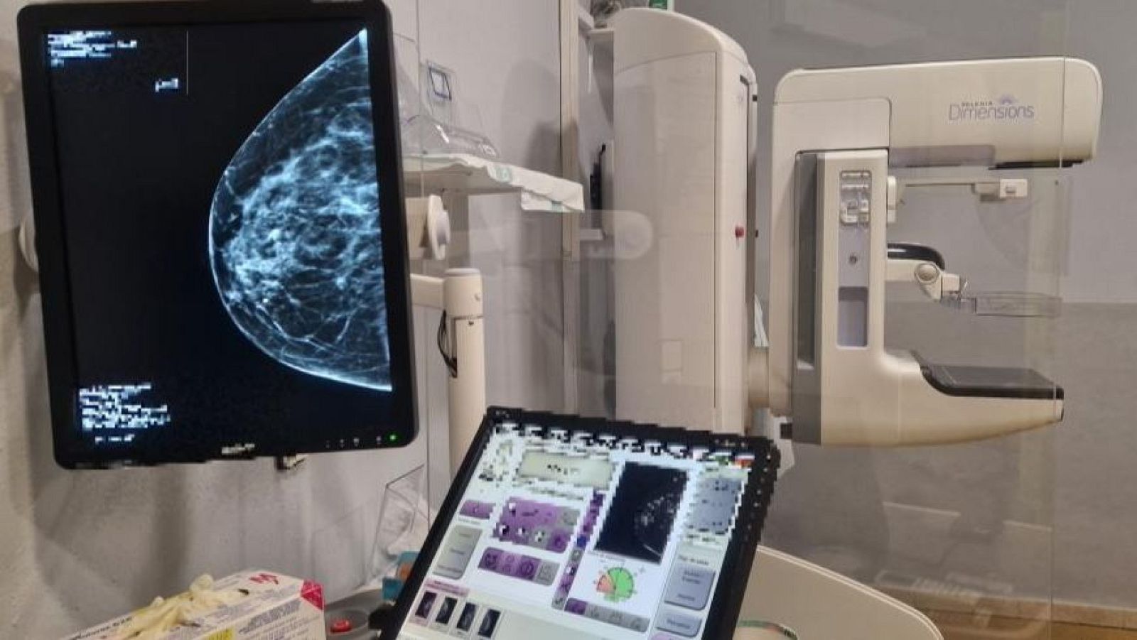 Uno de los tres mamógrafos con los que cuenta el Hospital Nuestra Señora de Gracia en Zaragoza.