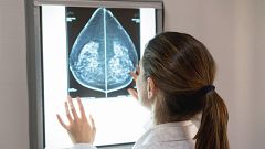 La Fiscalía de Andalucía abre una investigación por la denuncia de Amama sobre el 'borrado' de mamografías