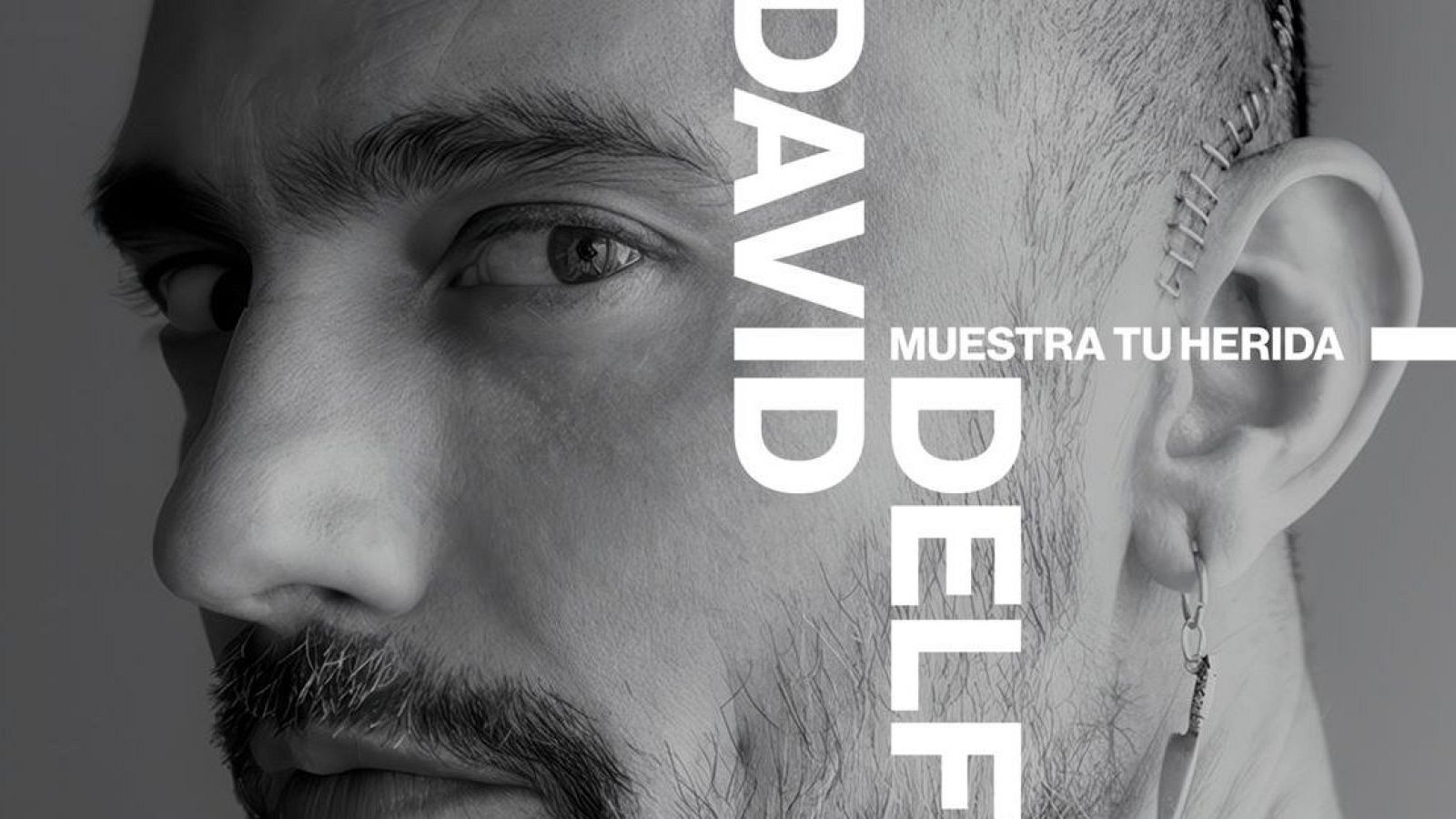 Cartel del documental 'David Delfín. Muestra tu herida'