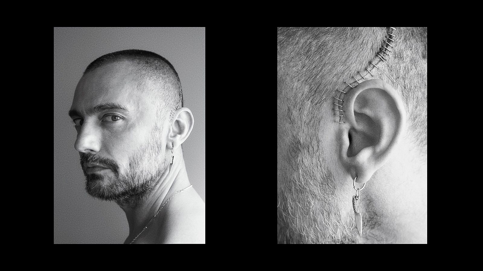 'David Delfín. Muestra tu herida': significado del título