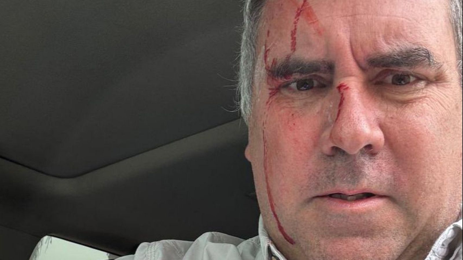 El candidato por la Presidencia de Perú Rafael Belaúnde, herido después de sufrir un atentado en su contra este martes