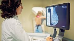 Los casos de cáncer de mama aumentarán un tercio en las próximas tres décadas, según un estudio