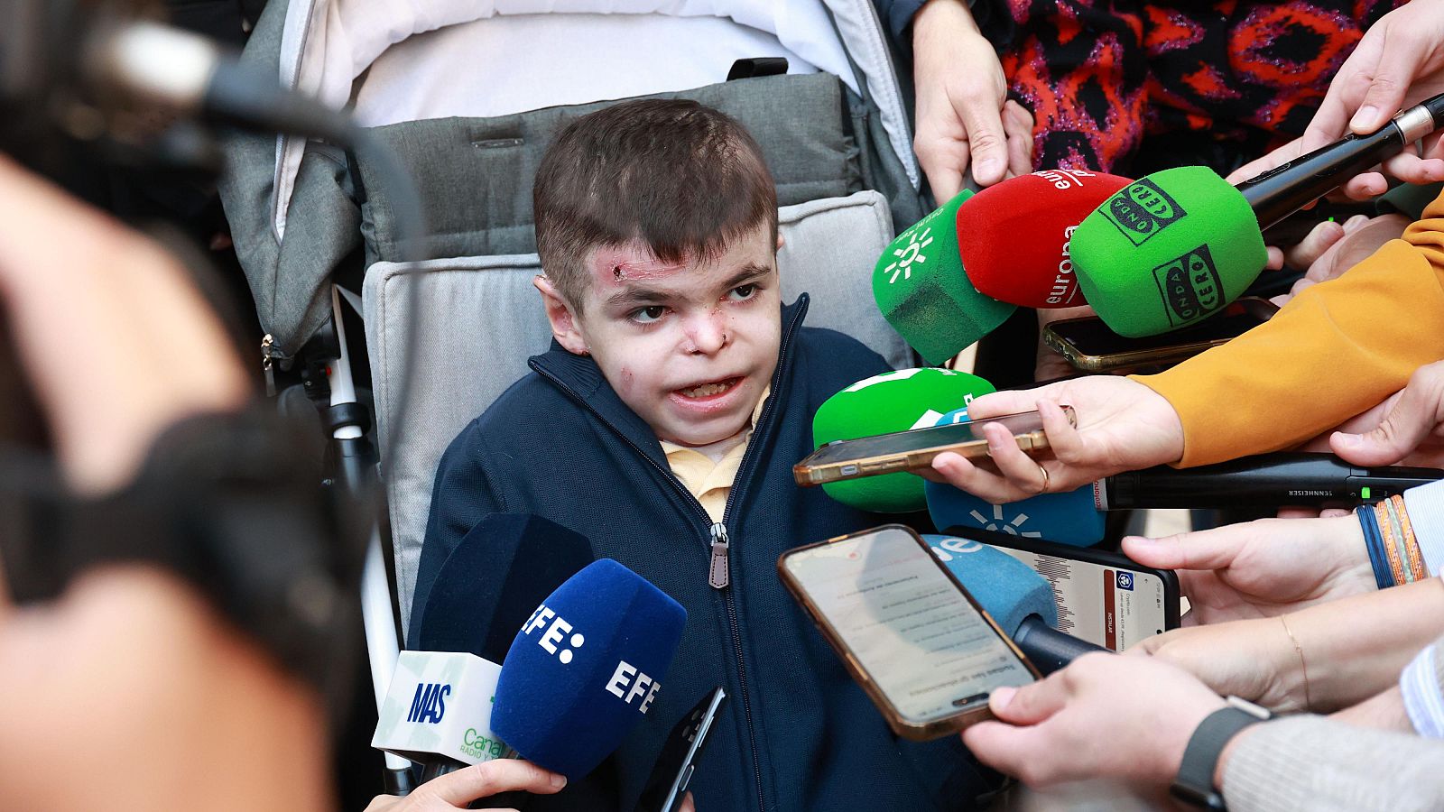 Leo, niño sevillano con piel de mariposa, rodeado de micrófonos durante una comparecencia