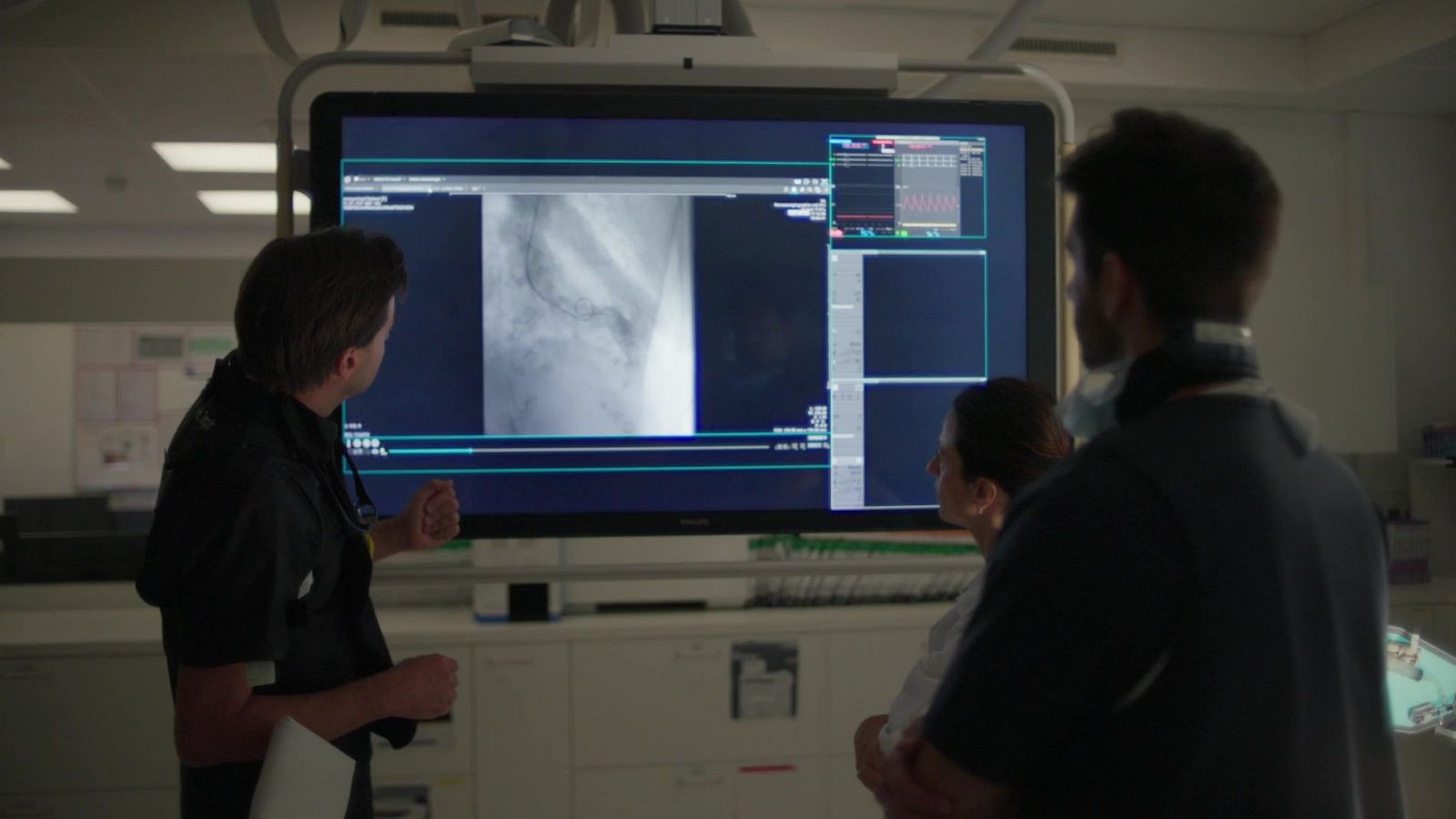 Especialistas en cardiología analizan una prueba diagnóstica del síndrome de Takotsubo o corazón roto en un hospital