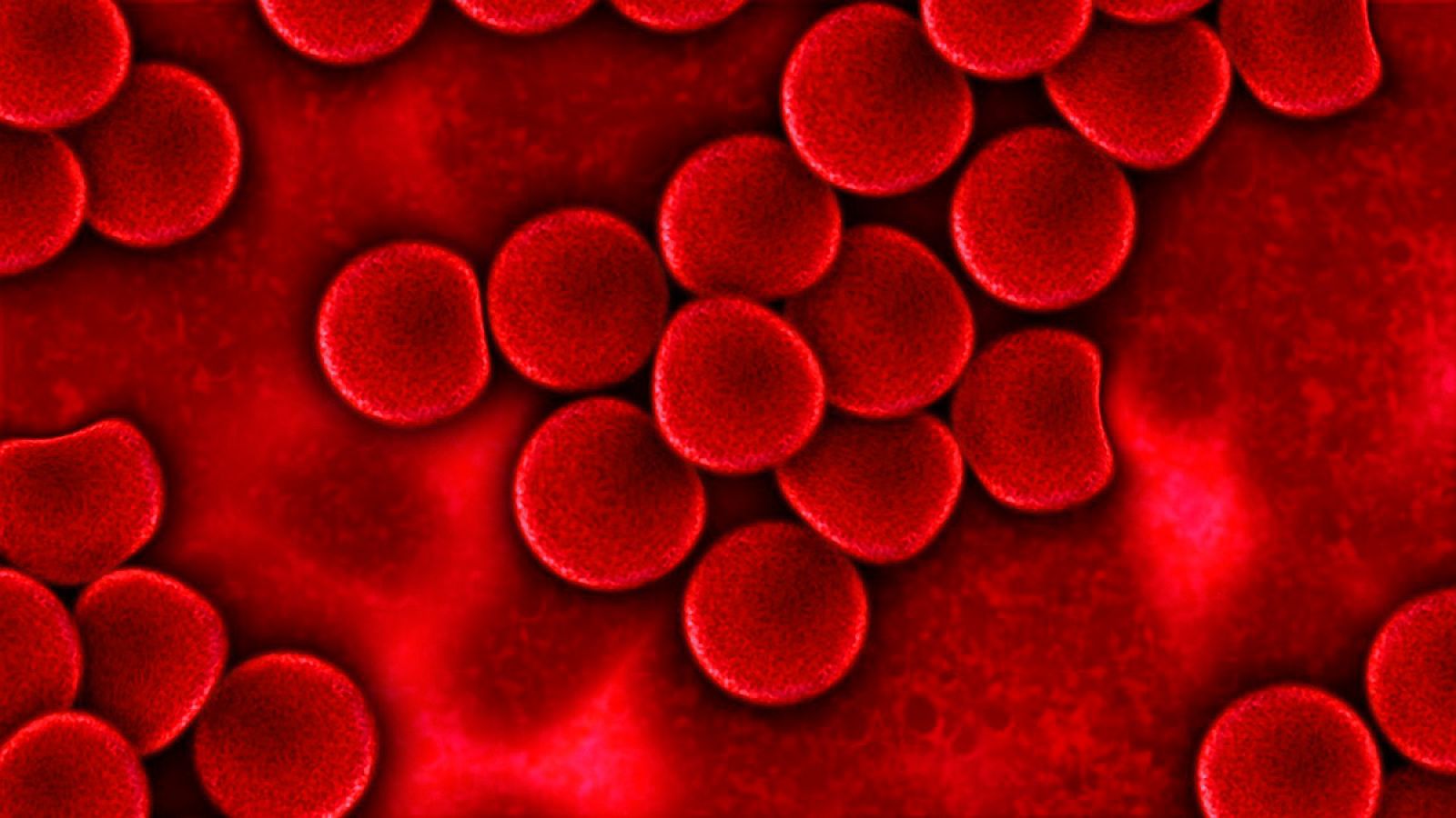 Las personas con cáncer son siete veces más propensas a sufrir una trombosis