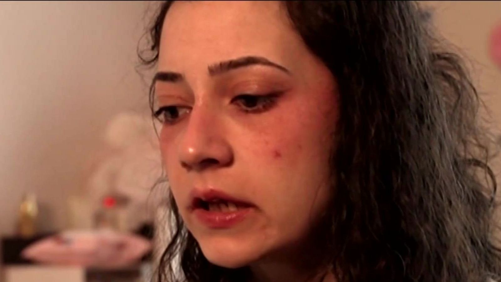 Primer plano de una mujer con cabello oscuro y rizado, piel clara y un lunar en la mejilla, con un fondo difuminado.