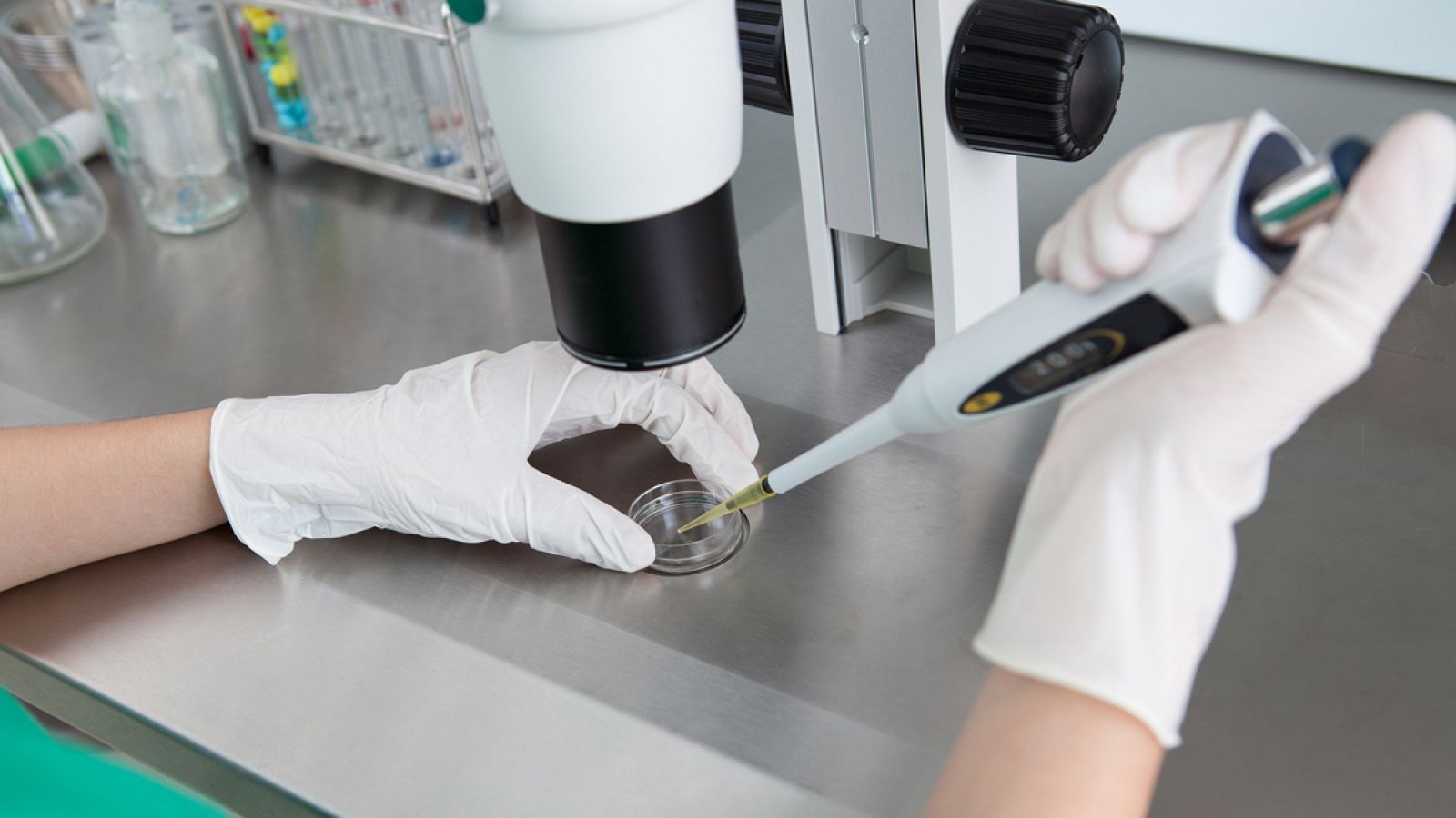 El cáncer colorrectal es el más diagnosticado en España entre hombres y mujeres, con 34.331 casos detectados en 2017.