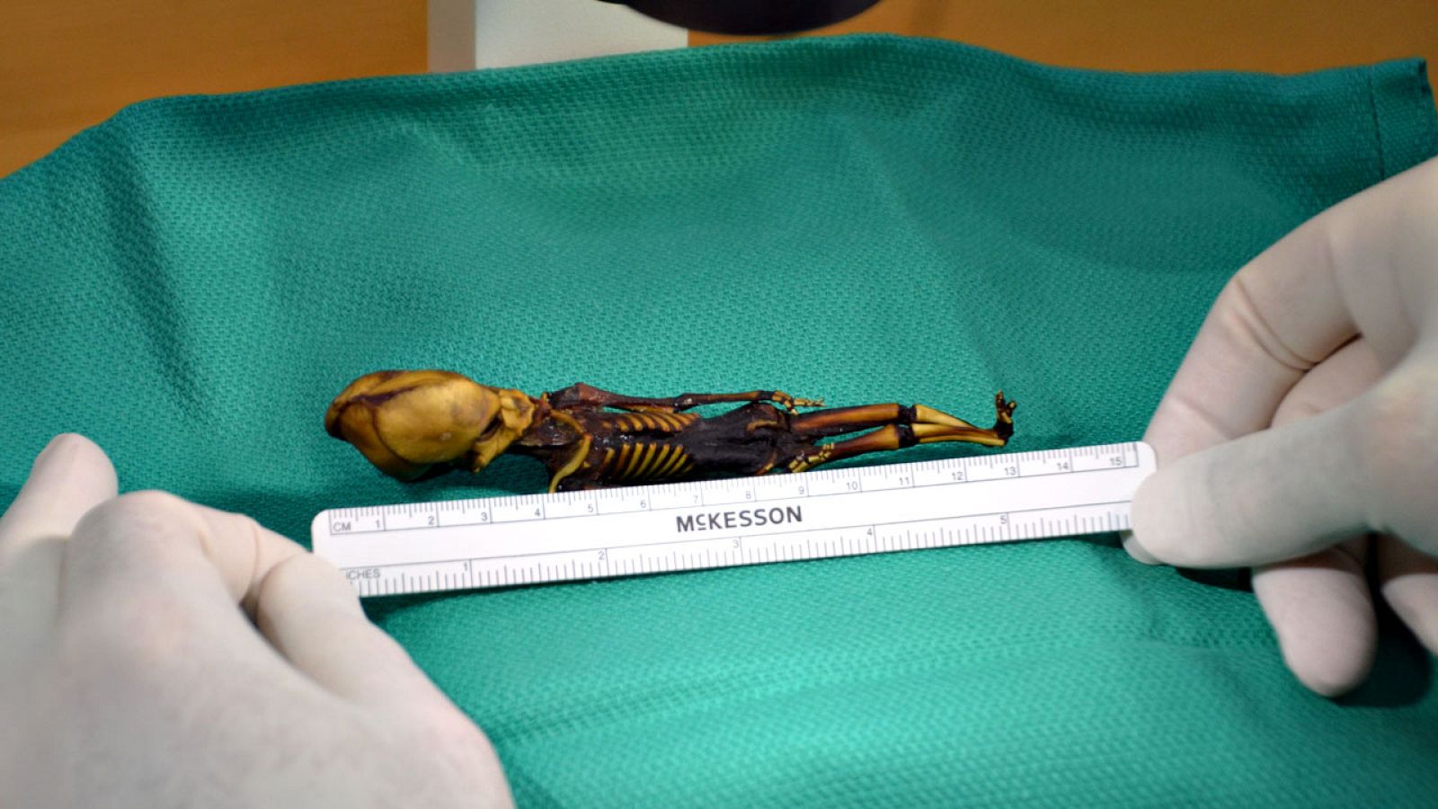 El esqueleto 'Ata', hallado en el desierto de Atacama, es el de un feto de niña con mutaciones óseas