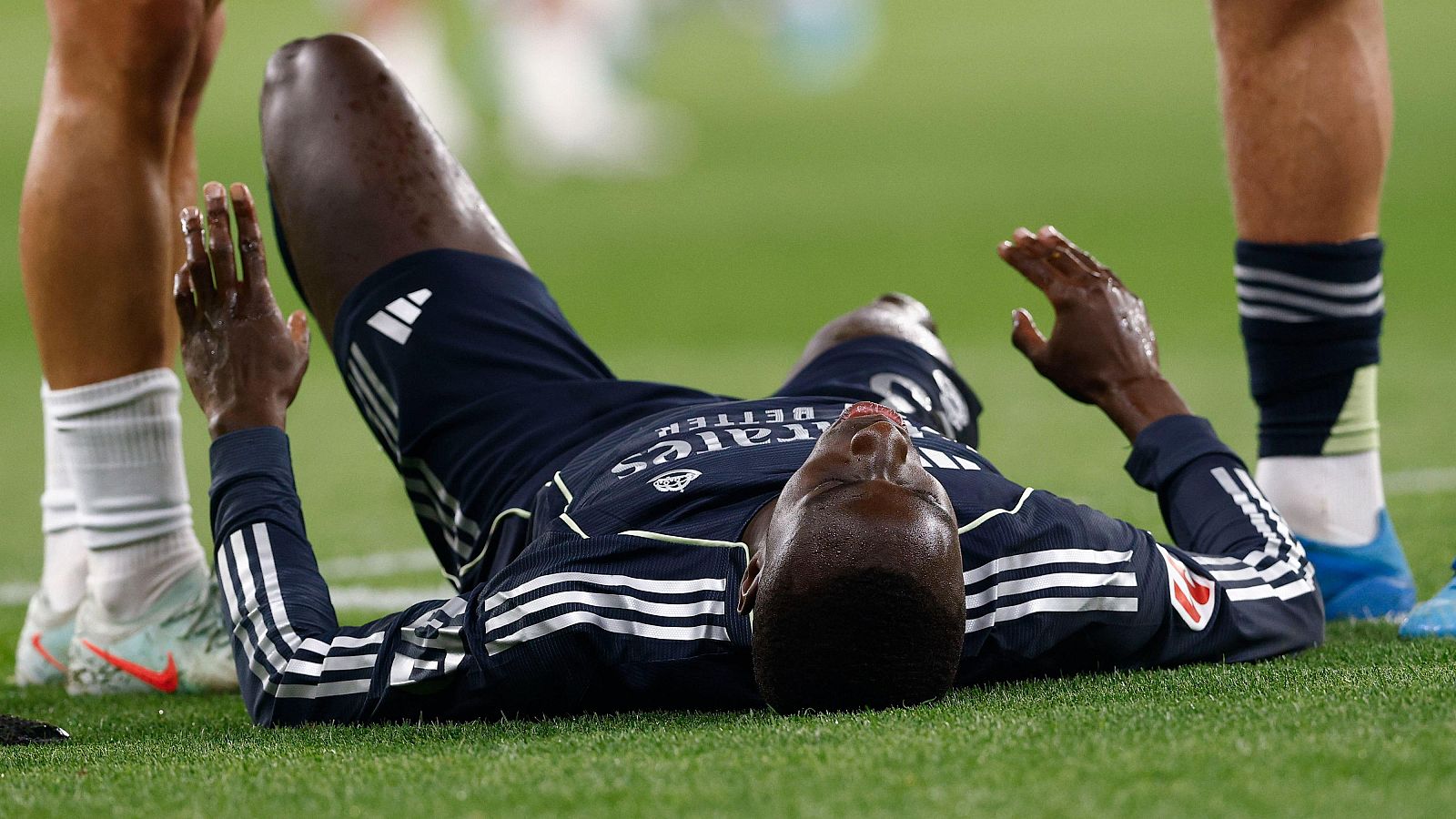 Ferland Mendy tendrá que operarse tras lesionarse en el último partido contra el Espanyol