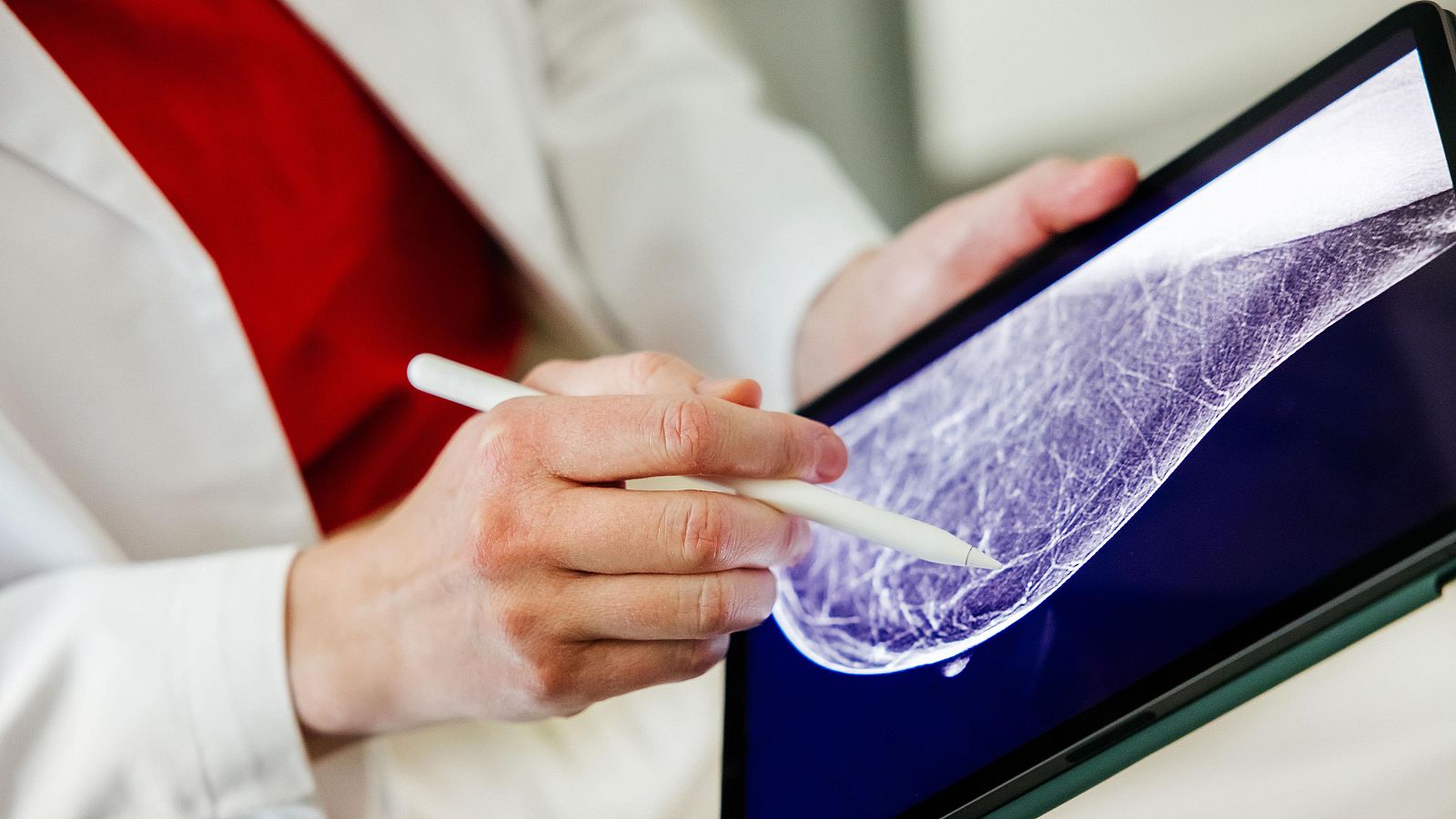Sanidad amplia el cribado de cáncer de mama a mujeres de entre 45 y 74 años