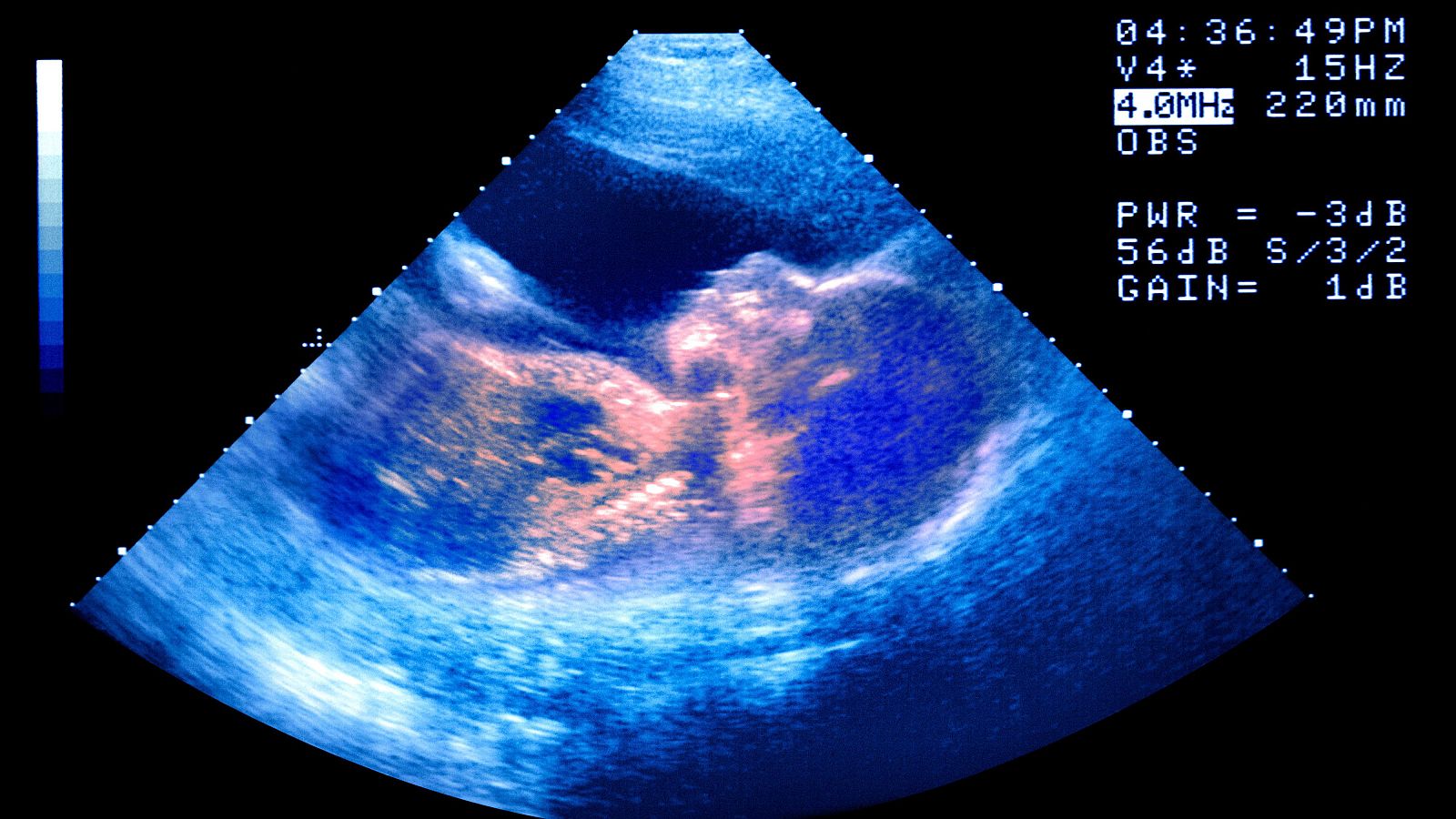 El embarazo por reproducción asistida: un deseo cumplido, una proeza médica, ¿un negocio?