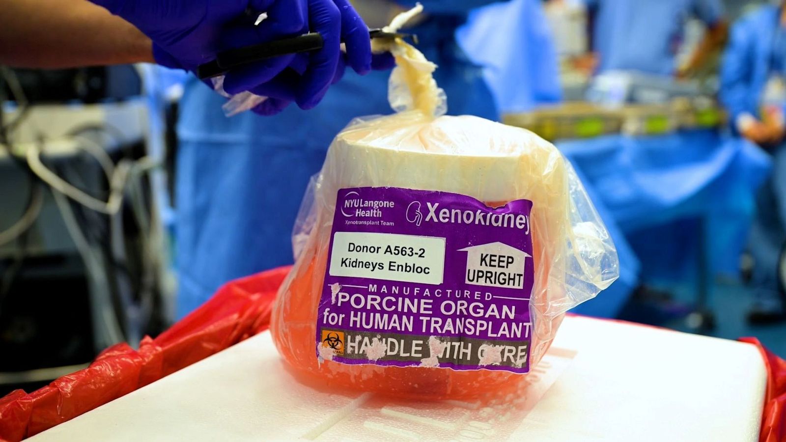 Paquete con riñones de cerdo para trasplante humano, etiquetado "Xenokidney", "NYU Langone Transplant Team", "Donor A563-2", "Kidneys Enbloc", "KEEP UPRIGHT", "HANDLE WITH CARE", y símbolo de riesgo biológico.