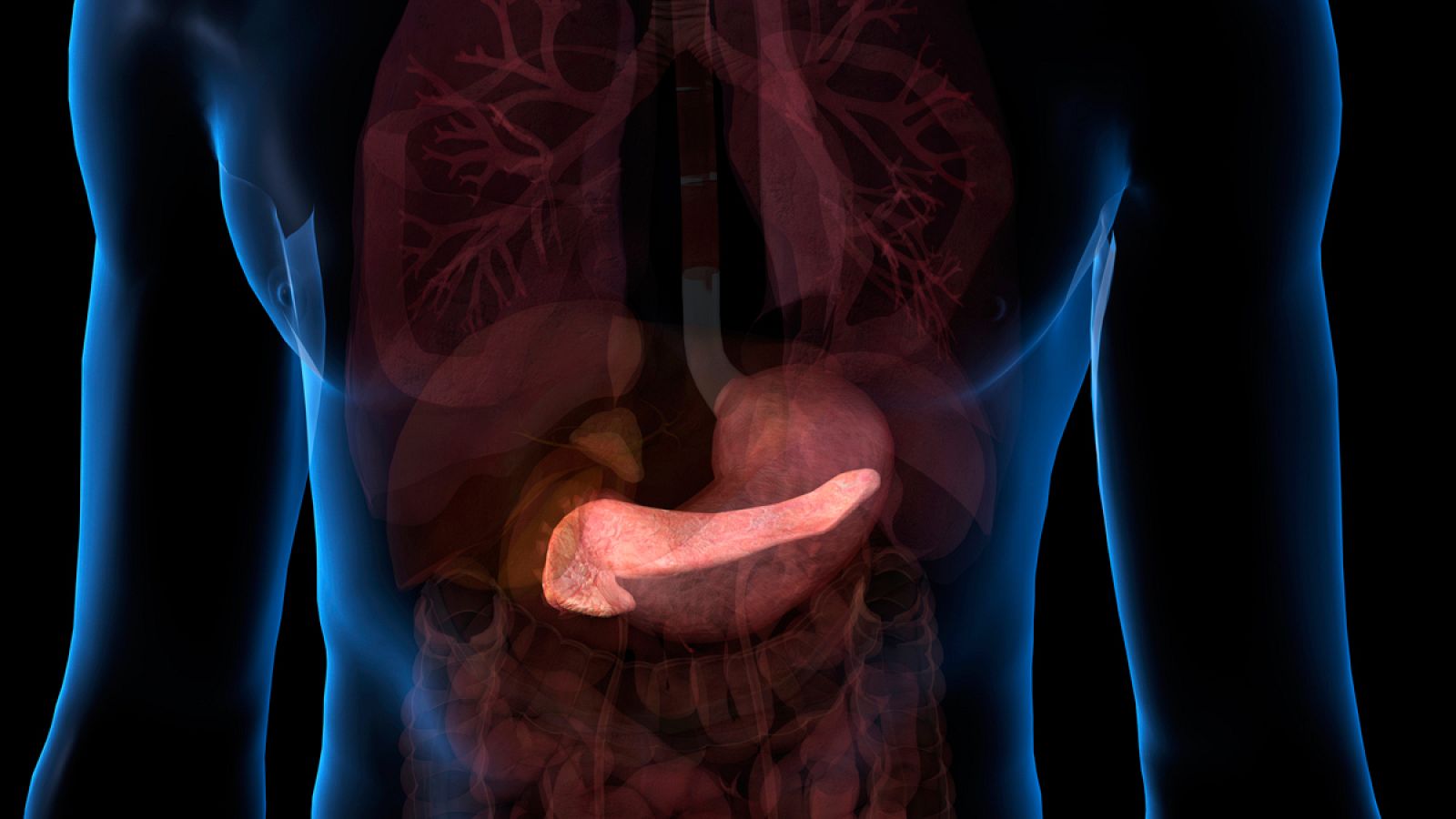 La diabetes tipo 1 aparece cuando el sistema inmune destruye sus células productoras de insulina en el páncreas.
