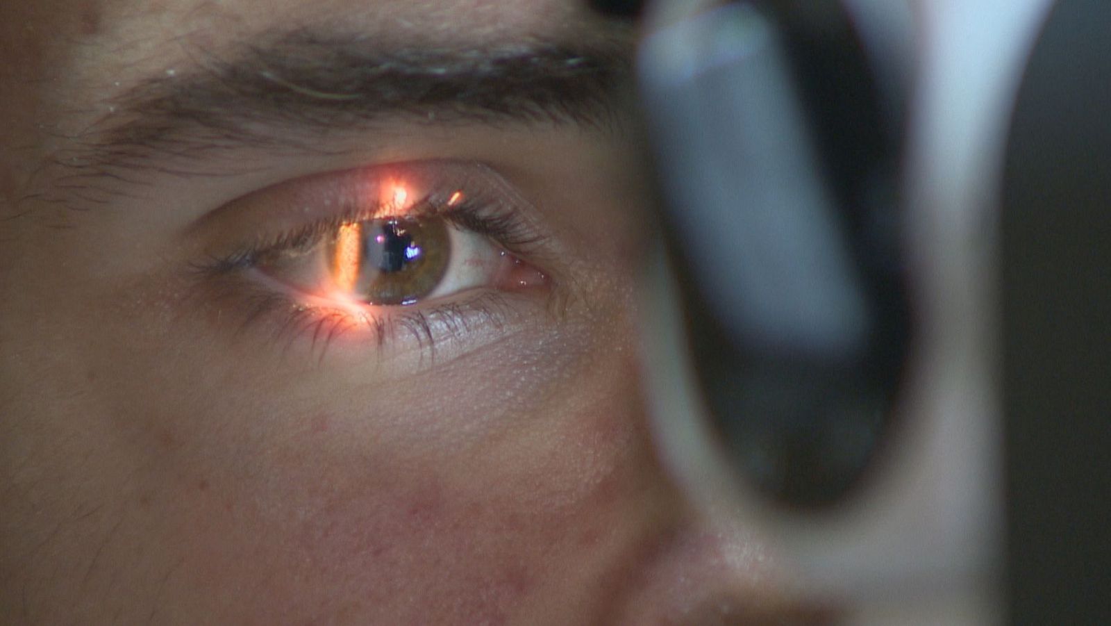 Primer plano de un ojo marrón claro siendo examinado con un haz de luz anaranjado-rojizo. Se ven pestañas, ceja y un instrumento oftalmológico borroso.