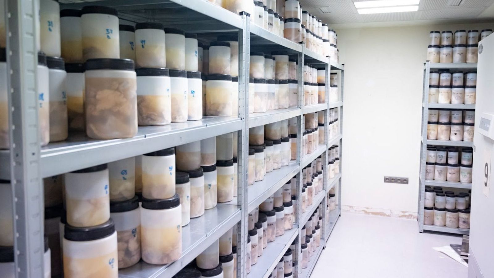 El Banco de Tejidos CIEN, donde los cerebros donados se convierten en investigación contra el Alzheimer