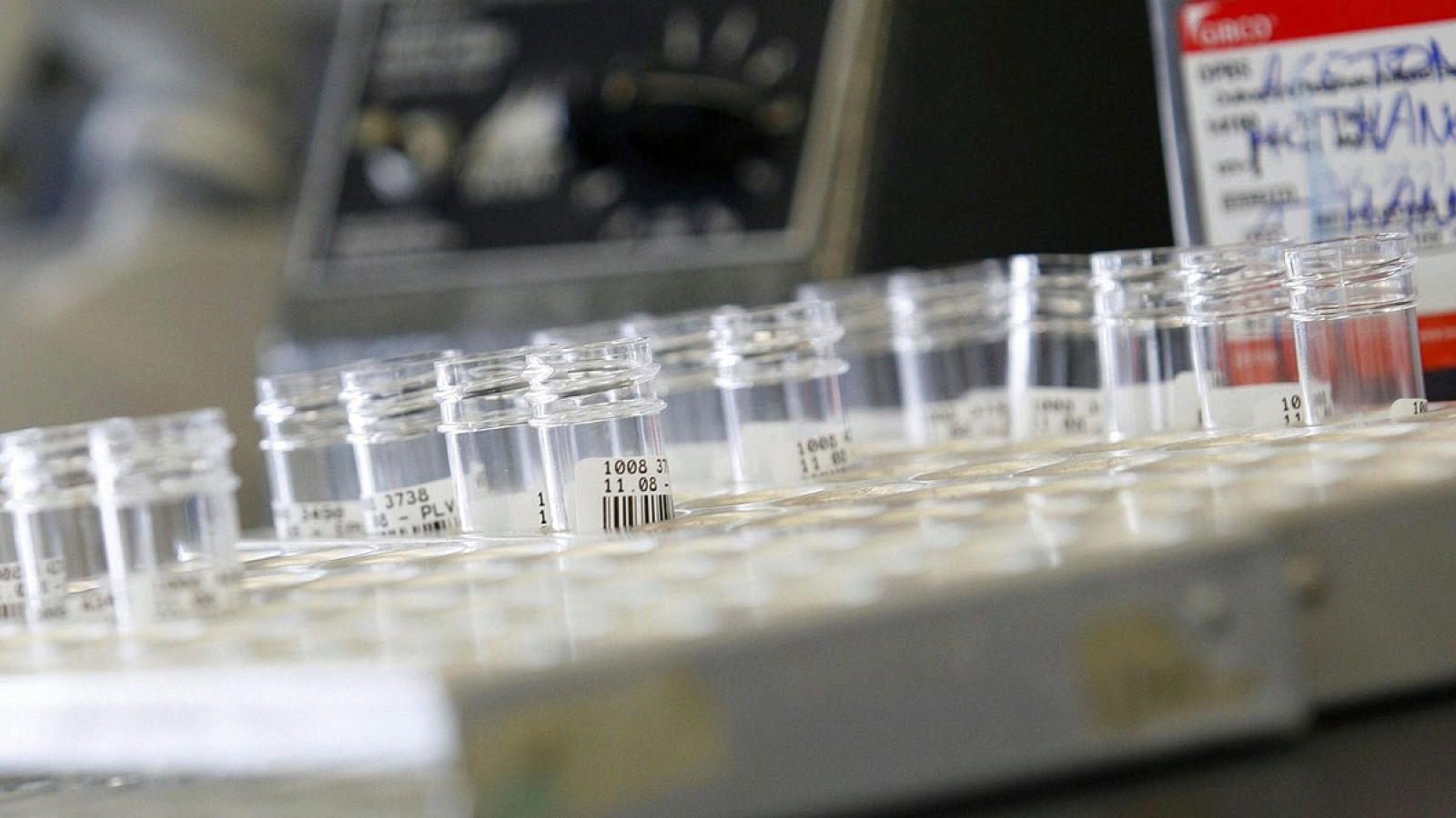 Los antibióticos orales pueden aumentar el riesgo de cálculos renales