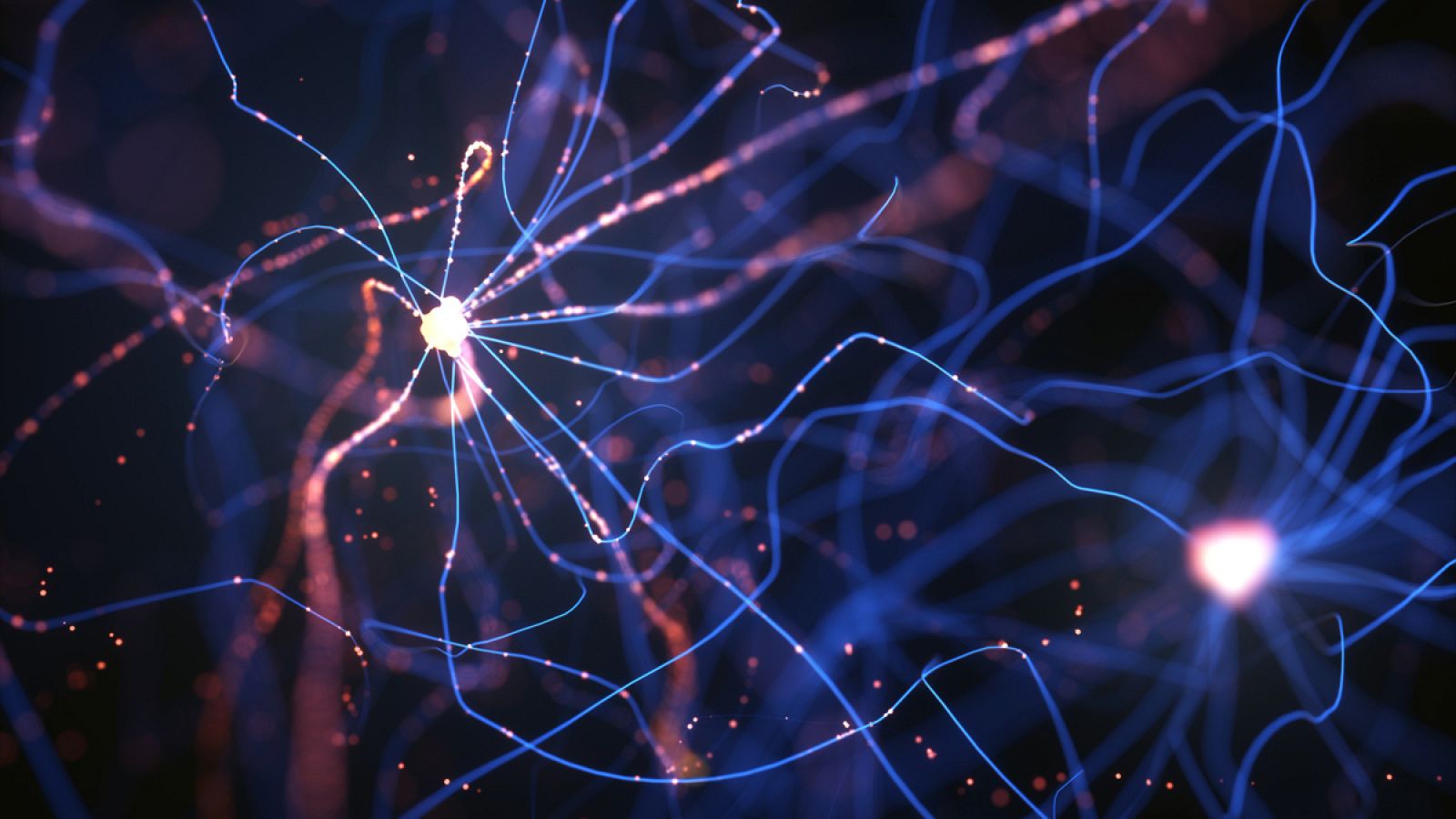 La enfermedad cerebrovascular es la primera causa de muerte en mujeres y la tercera en hombres.