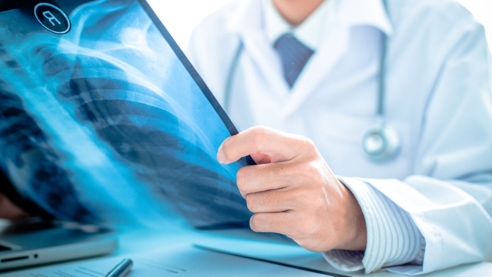 El de pulmón es uno de los tumores que presenta una incidencia más elevada.