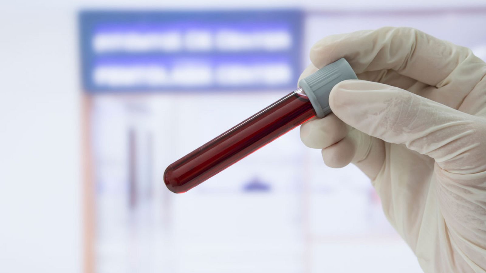 Solo el 30% de los pacientes consiguen controlar el colesterol tras un infarto.