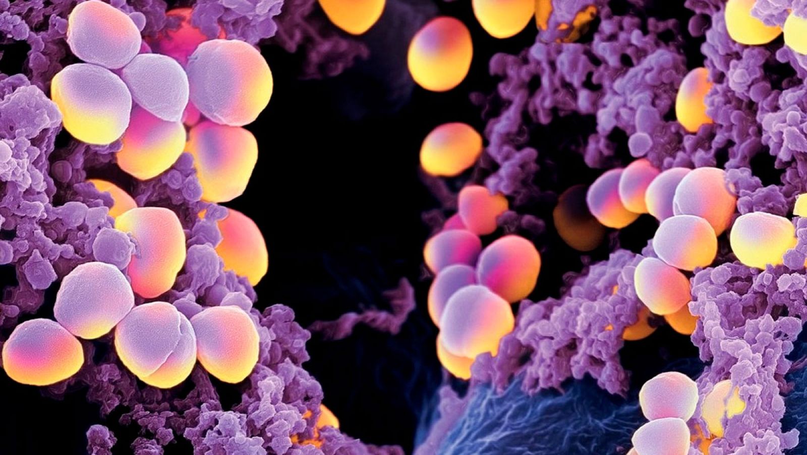 Staphylococcus Aureus, una de las bacterias más peligrosas que son capaces de combatir estos dos antibióticos.