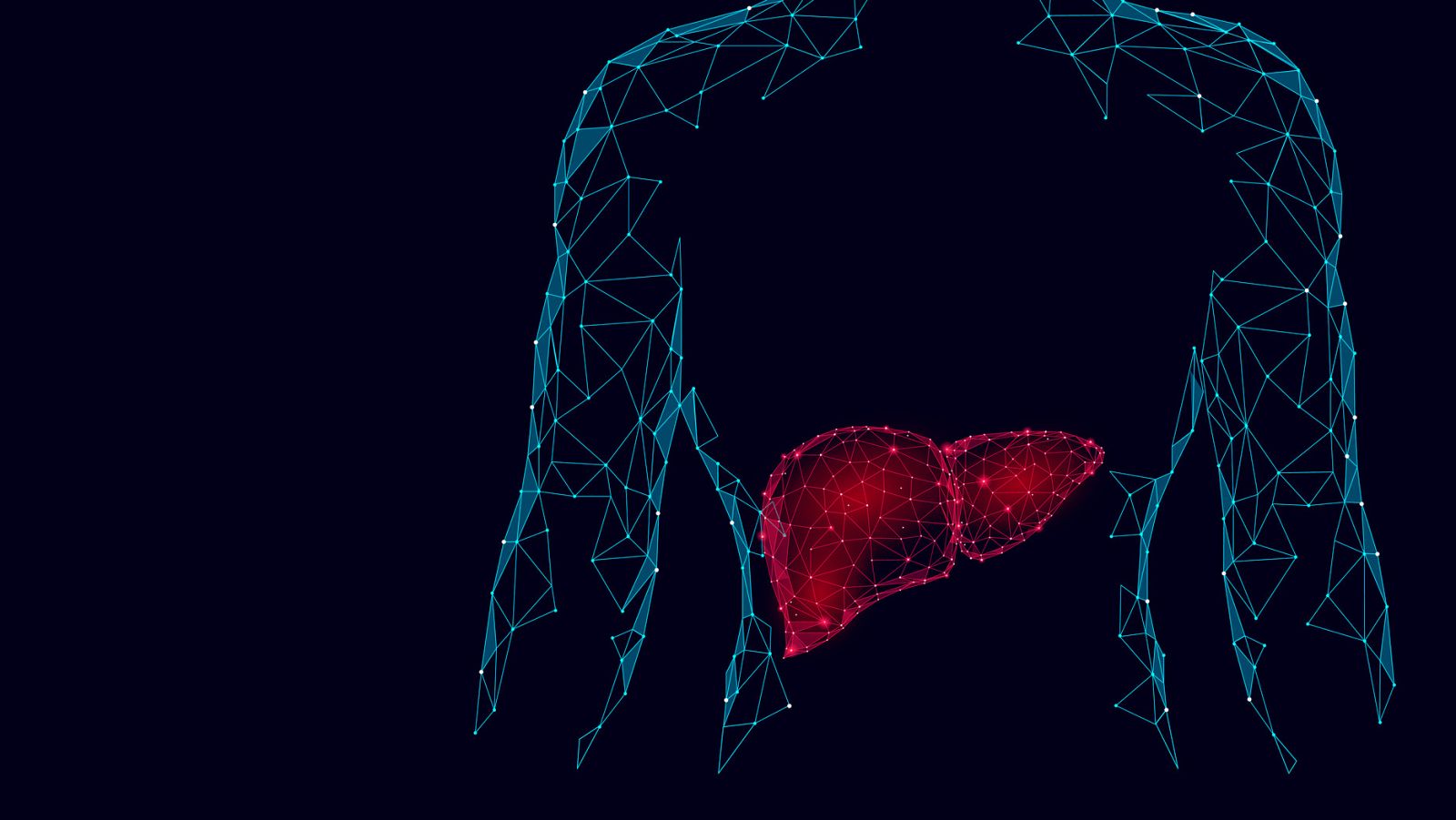 La enfermedad por hígado graso no alcohólico es la patología crónica más frecuente del hígado en los países occidentales.