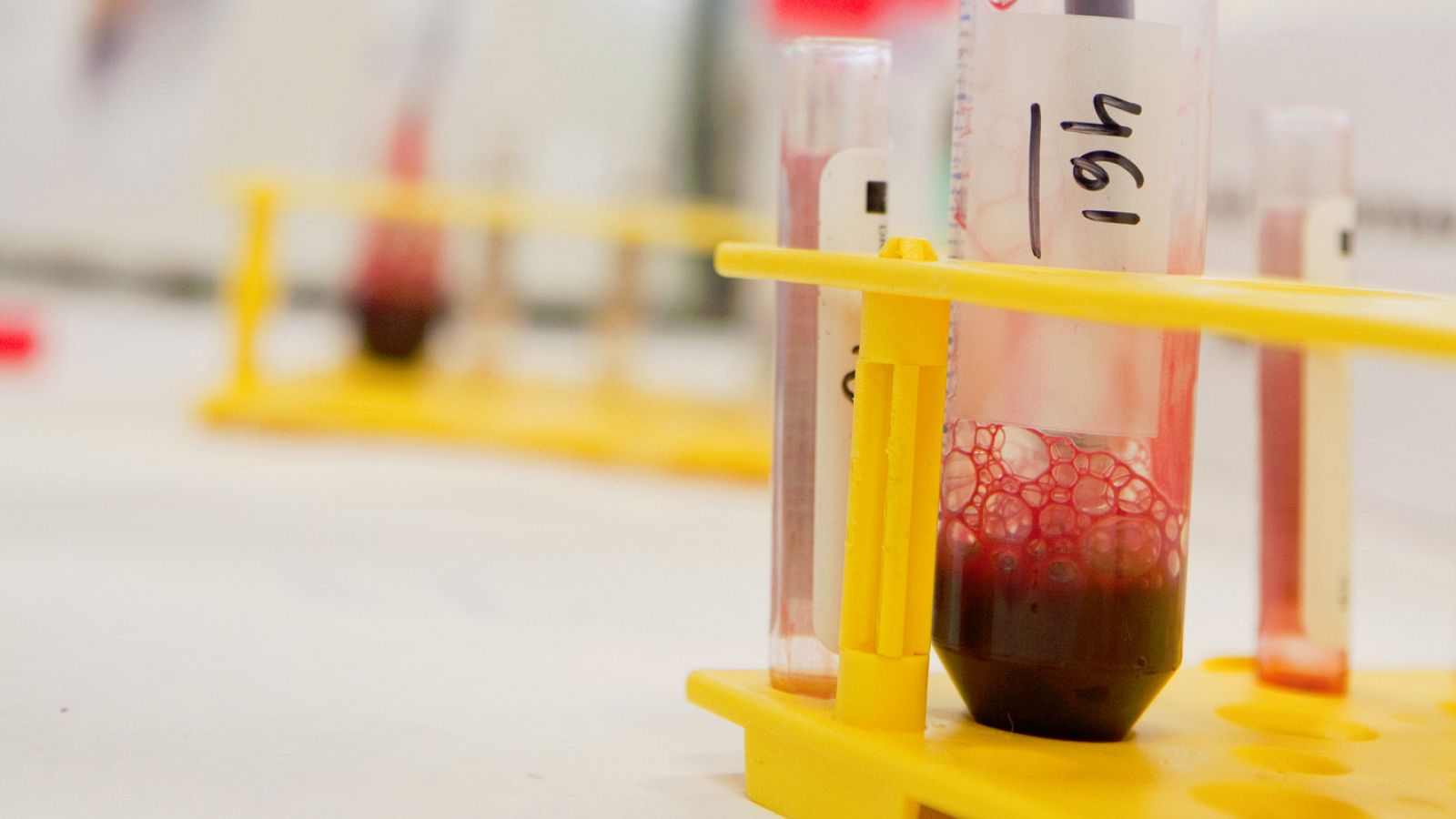 La donación de médula se rige por el principio de solidaridad universal, recuerdan desde la Organización Nacional de Trasplantes.