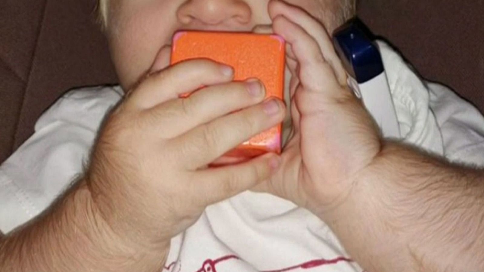 Uno de los bebés afectados por hipertricosis