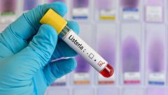 El brote de listeriosis sitúa bajo el foco la seguridad alimentaria