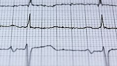 Los cardiólogos alertan de que pacientes con infartos "no acuden a urgencias por miedo a contagiarse"
